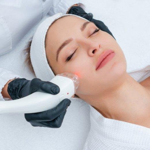 Image of model receiving laser therapy