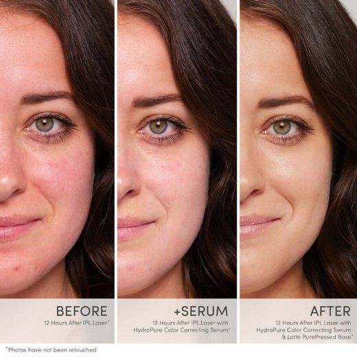 Jane Iredale Hydropure Correcting Serum results Jane Iredale Hydropure Correcting Serum results