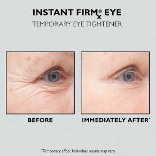 firmx eye tightener firmx eye tightener