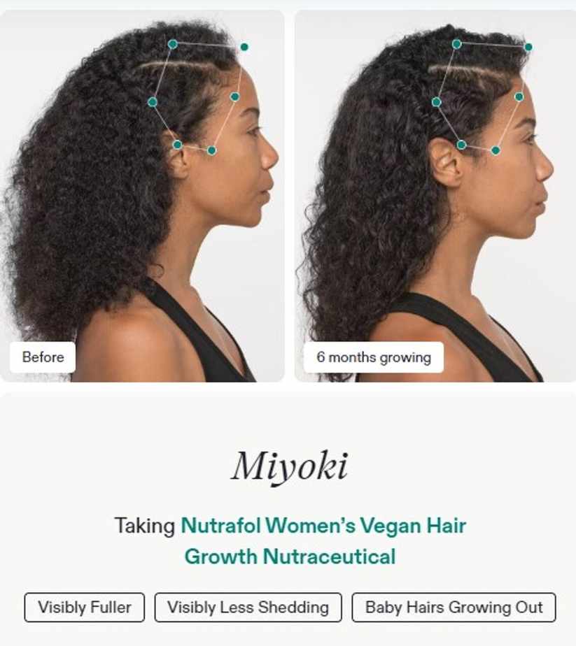 Fact Sheet About Nutrafol Women's Vegan Hair Growth Working