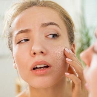 dry flaky skin dry flaky skin