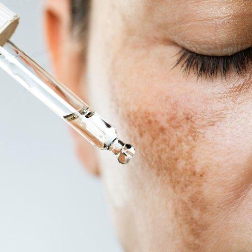 Professional Skin Treatments Professional Skin Treatments