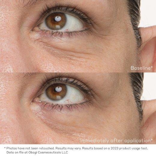 Under-eye area Under-eye area